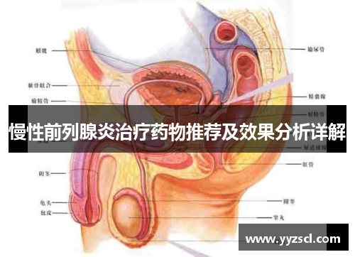 慢性前列腺炎治疗药物推荐及效果分析详解